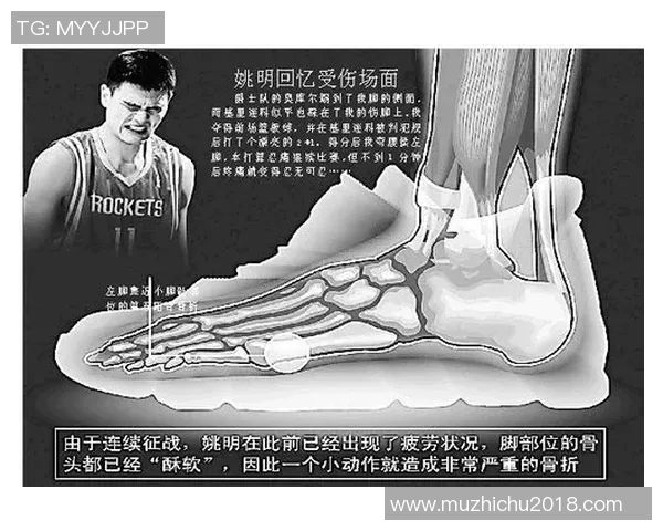 姚明骨折照片引发热议球迷心痛不已运动员健康问题再度被关注