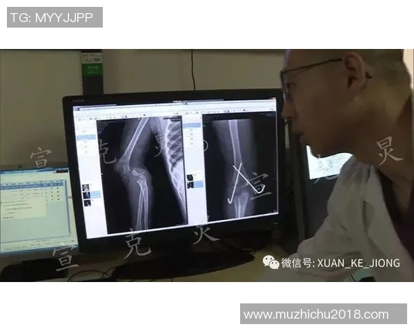 篮球明星意外遭遇腿截肢事件引发社会关注与体育界反思